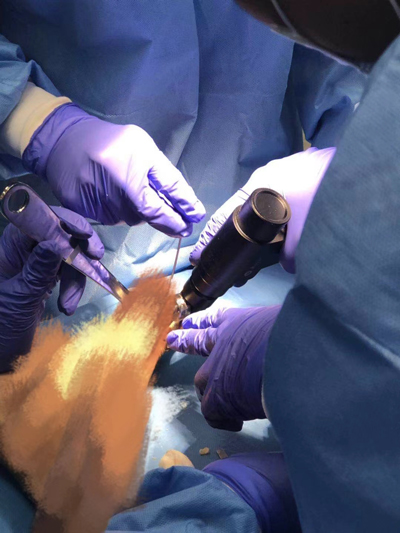 Orthopedic Saws